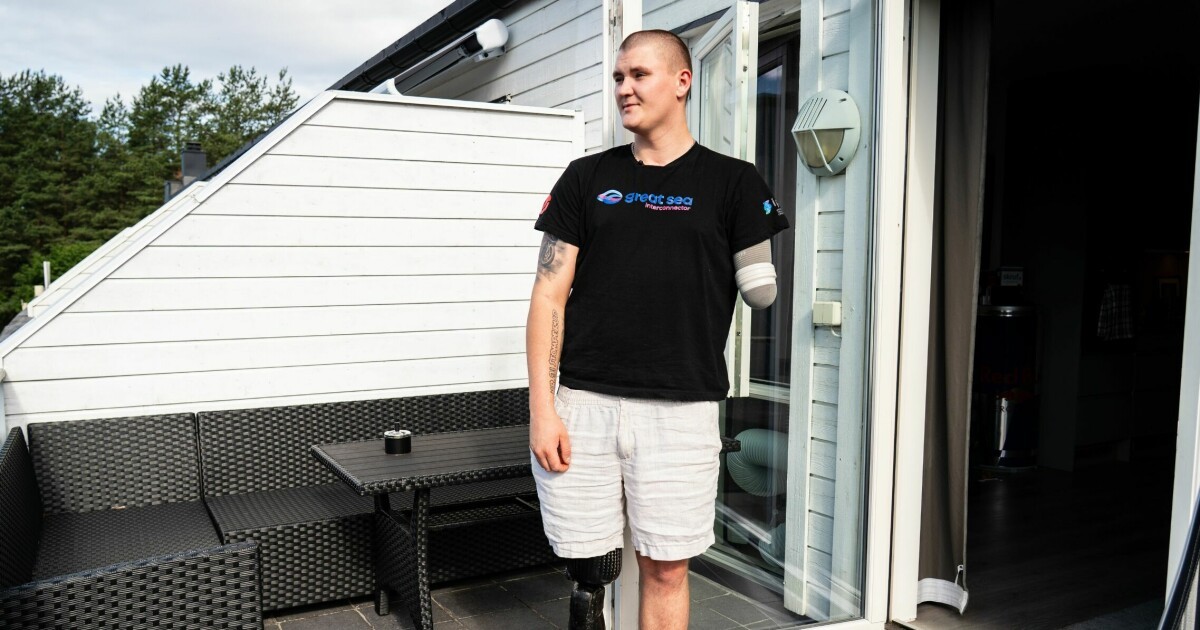 Victor (21) mistet beinet i MC-ulykke: – Jeg synes synd på kvinnen som fant meg
